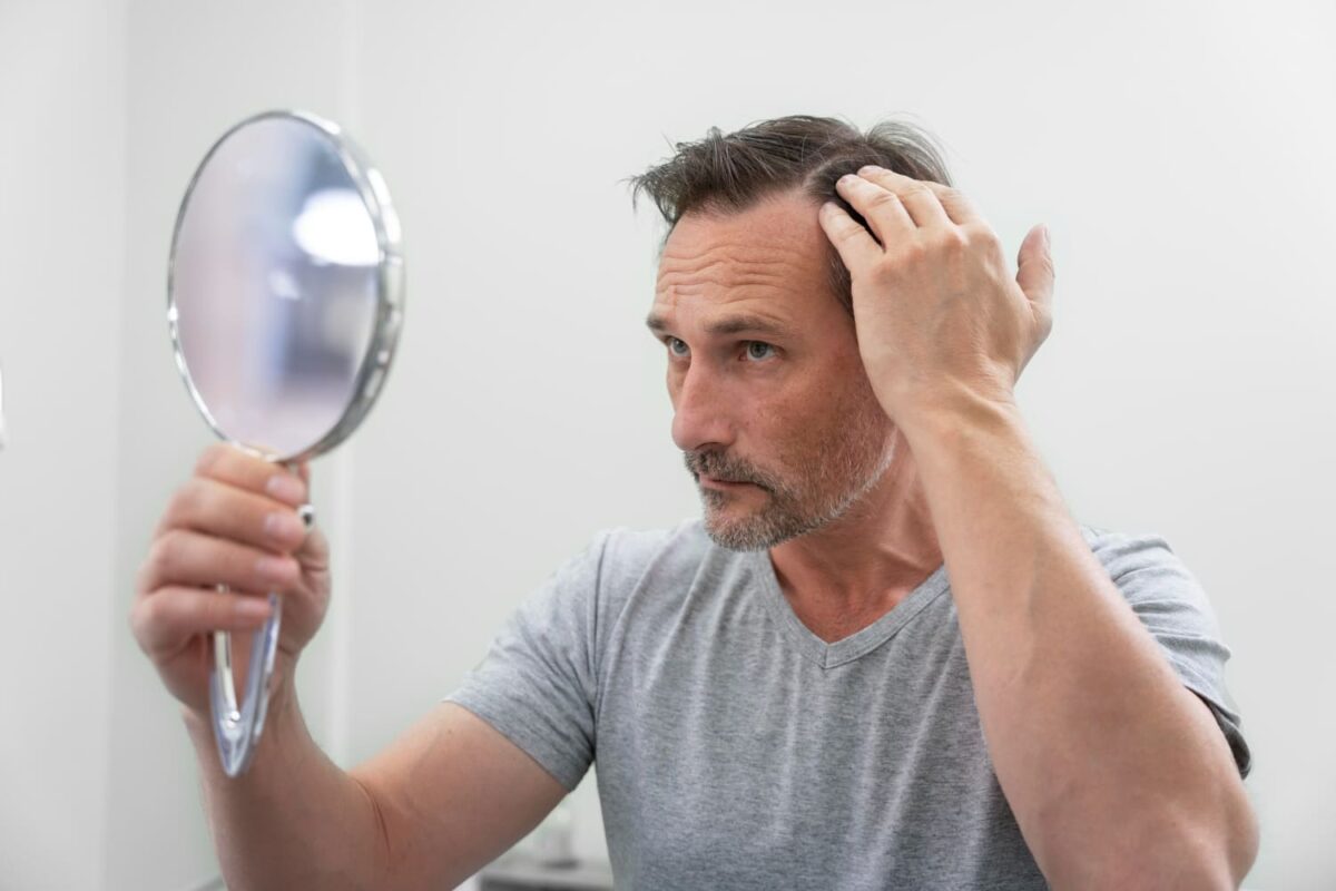 Queda de Cabelo Masculina: Como Evitar e Fortalecer os Fios