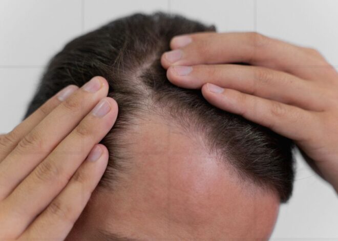 Como Disfarçar as Entradas no Cabelo Masculino: Cortes, Truques e Soluções Reais